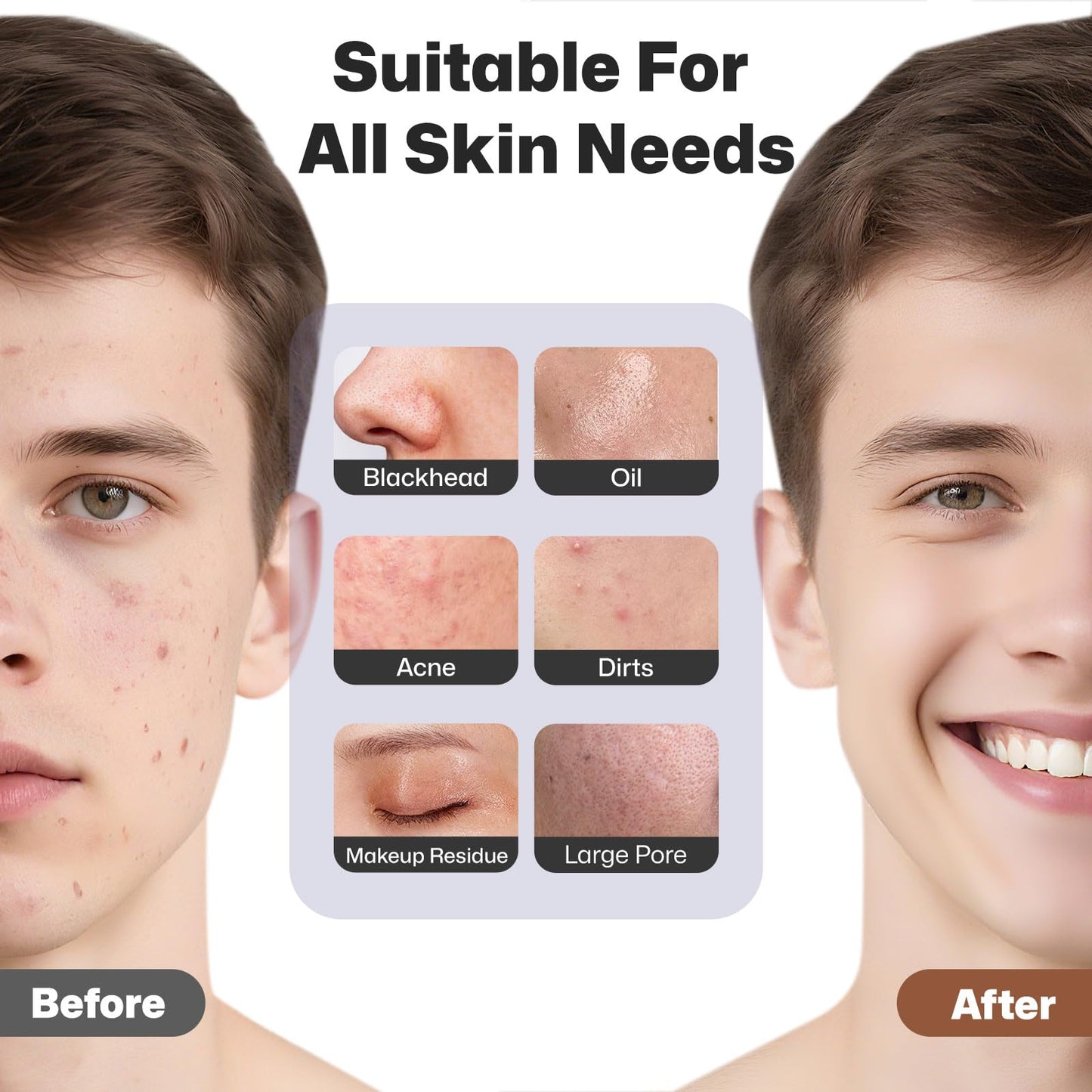 Silicone Face Scrubber, Rechargeable Facial Cleansing Brush with Heat Massage End, Vibrating Exfoliator Scrubber for Deep Cleaning, Waterproof Face Brush for Women and Men